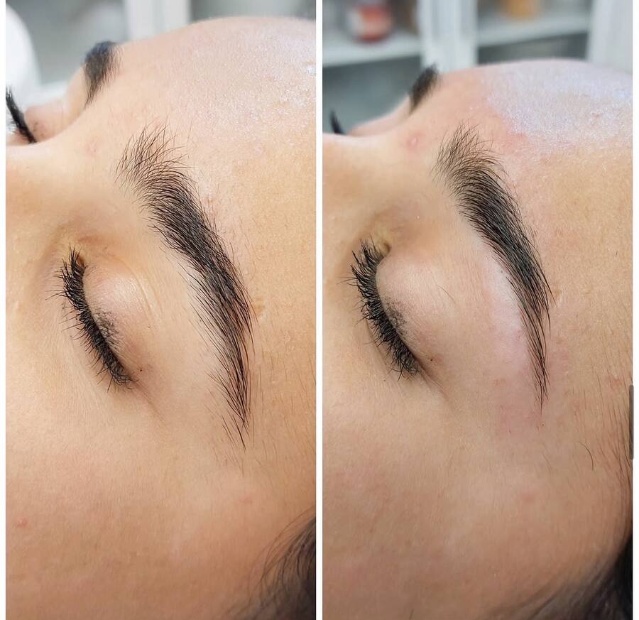 Resultado de tratamiento de cejas, antes y después