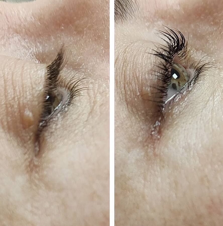 Resultado de tratamiento de pestañas, antes y después